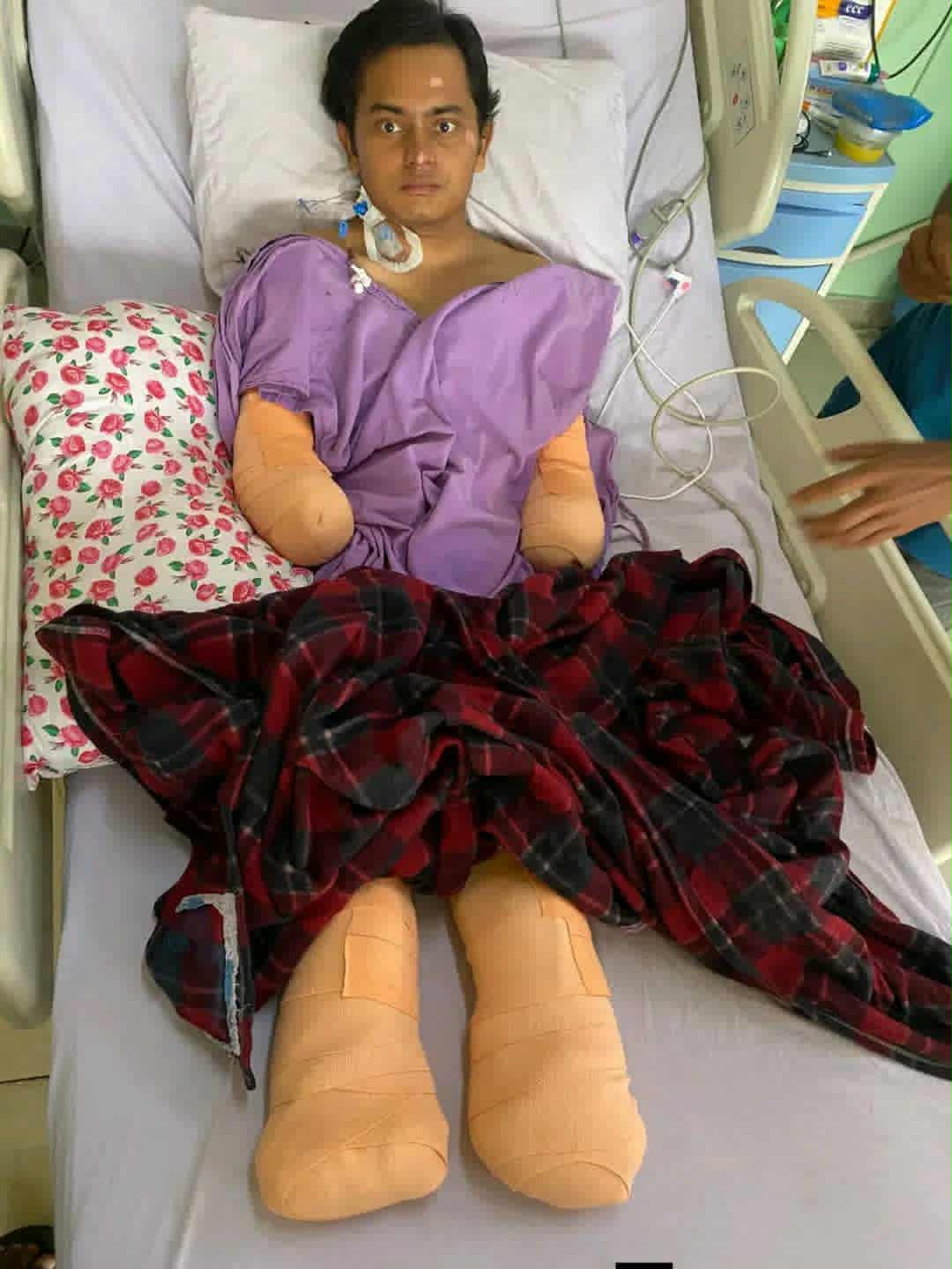 नेपाल डेरी एसोसिएसन कोशी प्रदेशद्वारा दुवै हातखुट्टा गुमाएका उमेश खातीलाई आर्थिक सहयोग नेपाल डेरी एसोसिएसन कोशी प्रदेशद्वारा दुवै हातखुट्टा गुमाएका उमेश खातीलाई आर्थिक सहयोग